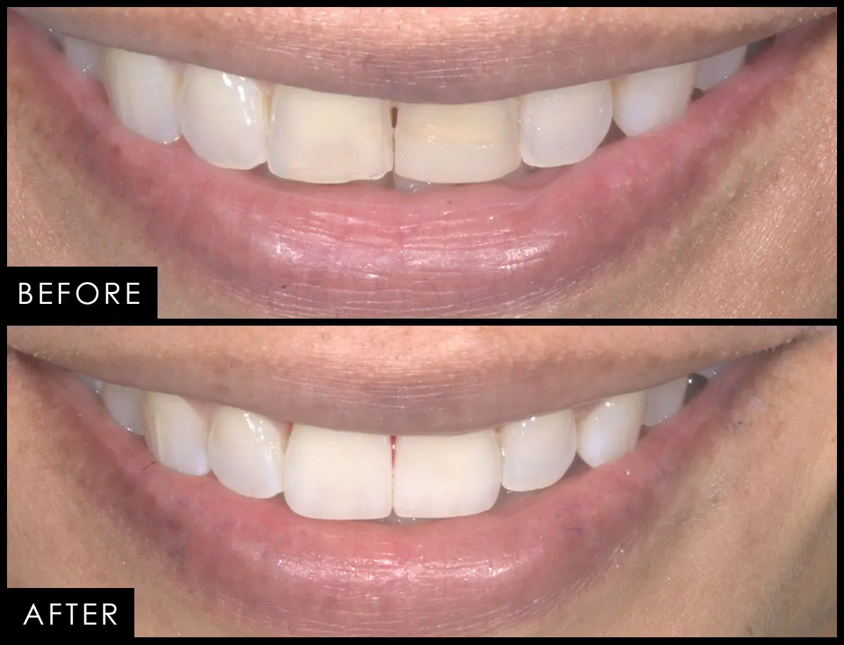 Patient case 07, before and after