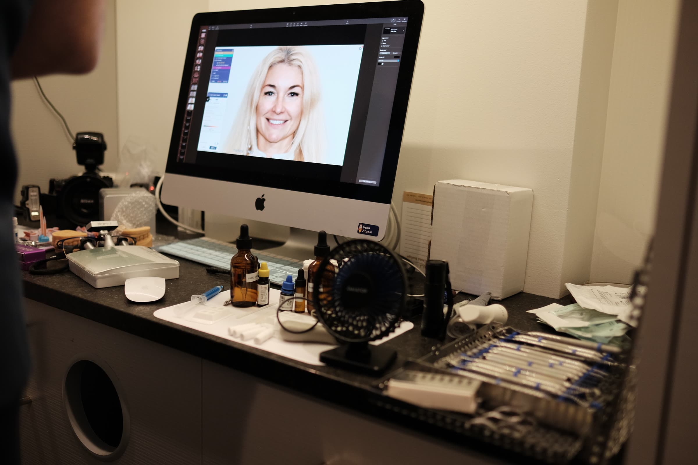 The photography workstation: a patient's smile on the screen beside the instruments