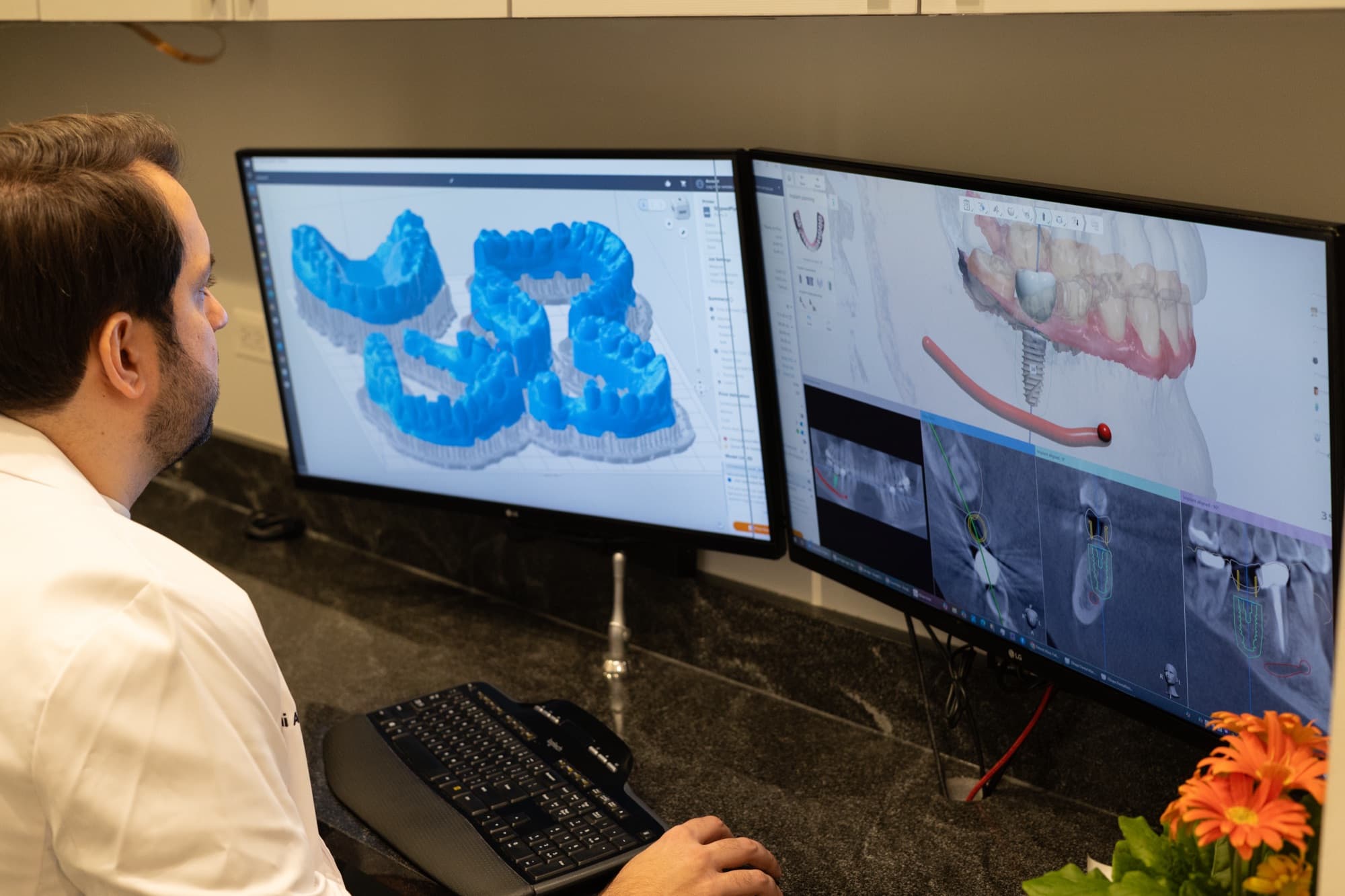 Dr. Atassi planning a case on screen