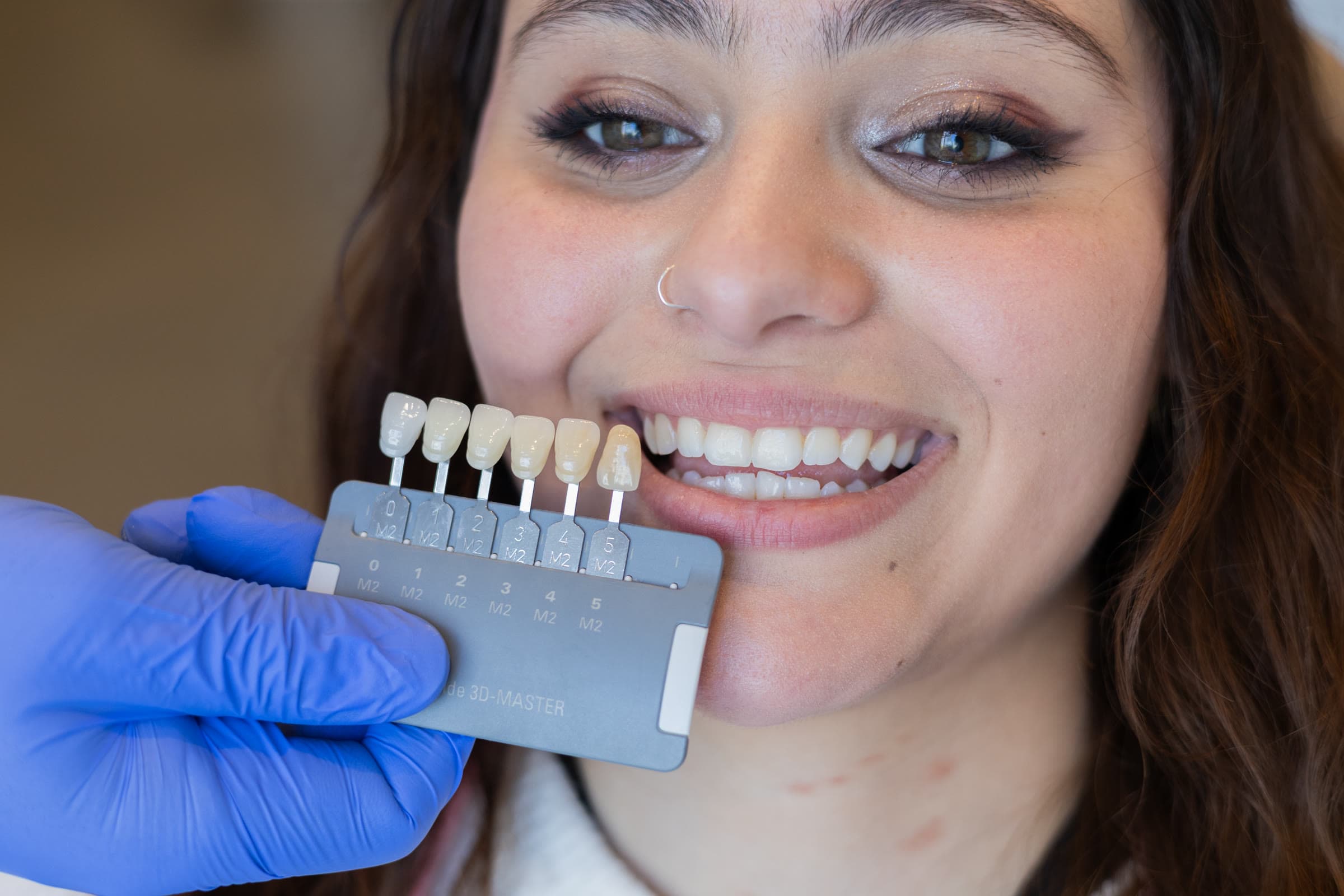 A shade guide held beside a patient's smile